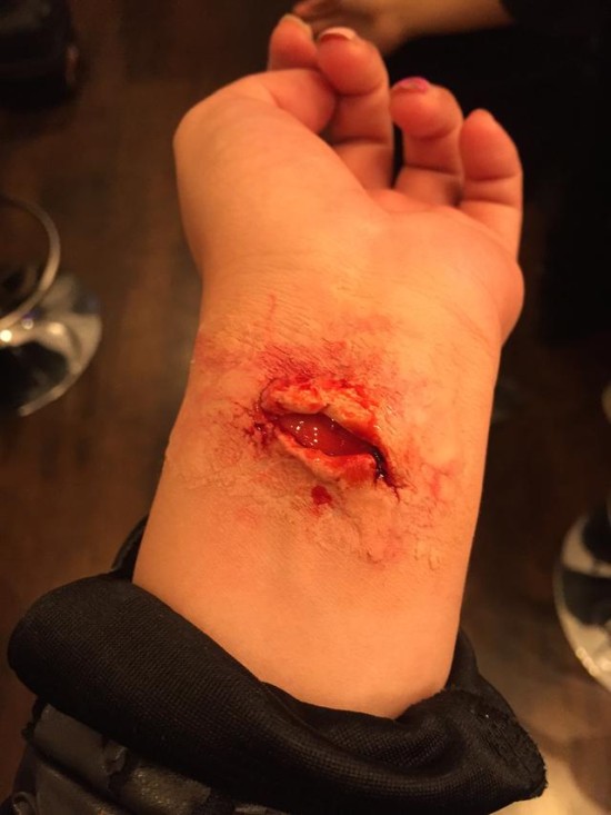 ��ʥ�� | 5���������˿�ױ������Ѫ�Ľ�ʬ���Ǻ���Ѫ��