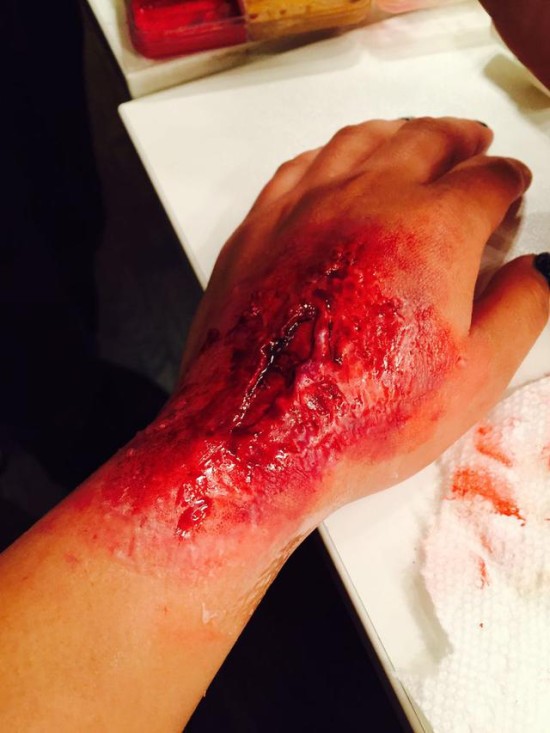 ��ʥ�� | 5���������˿�ױ������Ѫ�Ľ�ʬ���Ǻ���Ѫ��