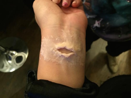 ��ʥ�� | 5���������˿�ױ������Ѫ�Ľ�ʬ���Ǻ���Ѫ��